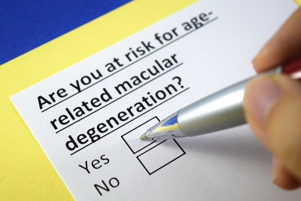 Risk factors of macular degeneration include age, family history, UV exposure and smoking